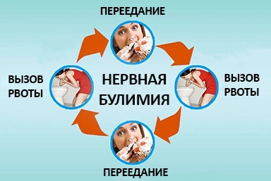 Лечение булимии в Балаклаве